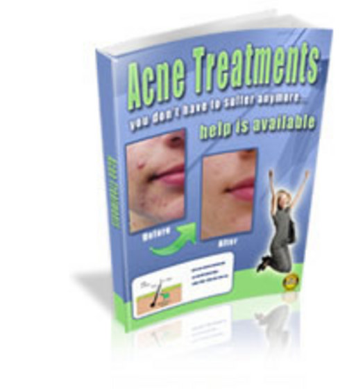 Product picture How to treat acne